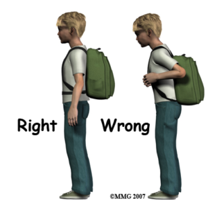 Backpack posture